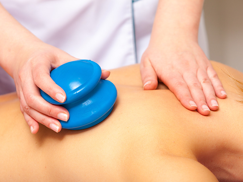 Massage aux ventouses cupping thérapeutique